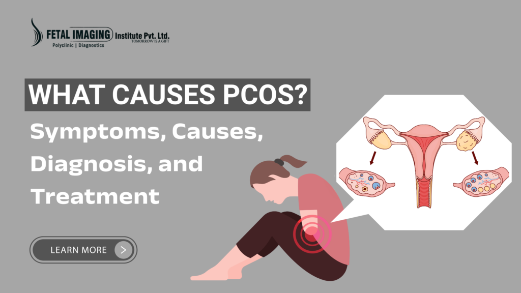 Polycystic Ovary Syndrome Treatment